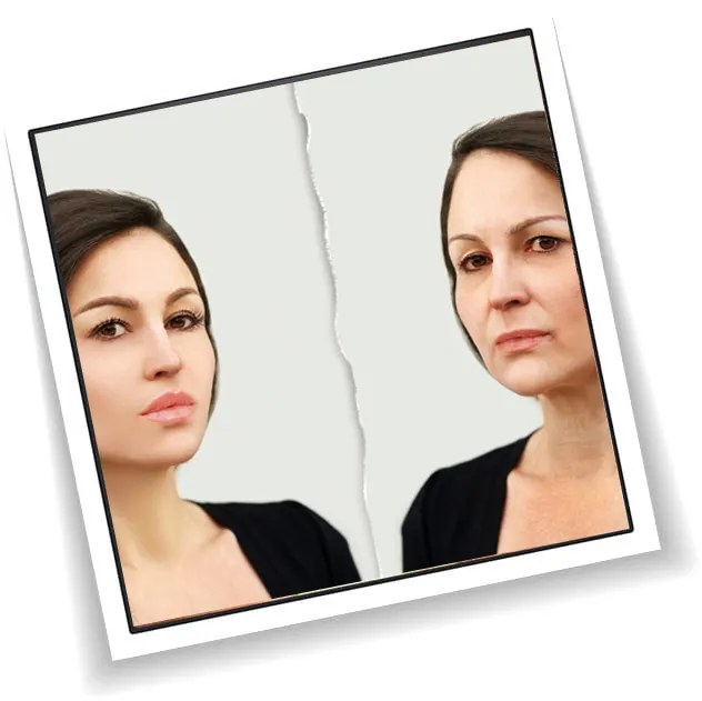 Before and after results from using EverBella Complete Collagen Plus